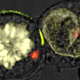 Image for article titled This Is the Highest Resolution Image Ever of a Killer Cell In Action